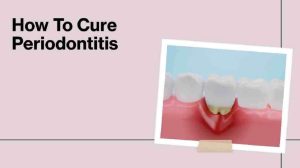 12 Expert Tips How To Cure Periodontitis – Say Goodbye to Gum Disease
