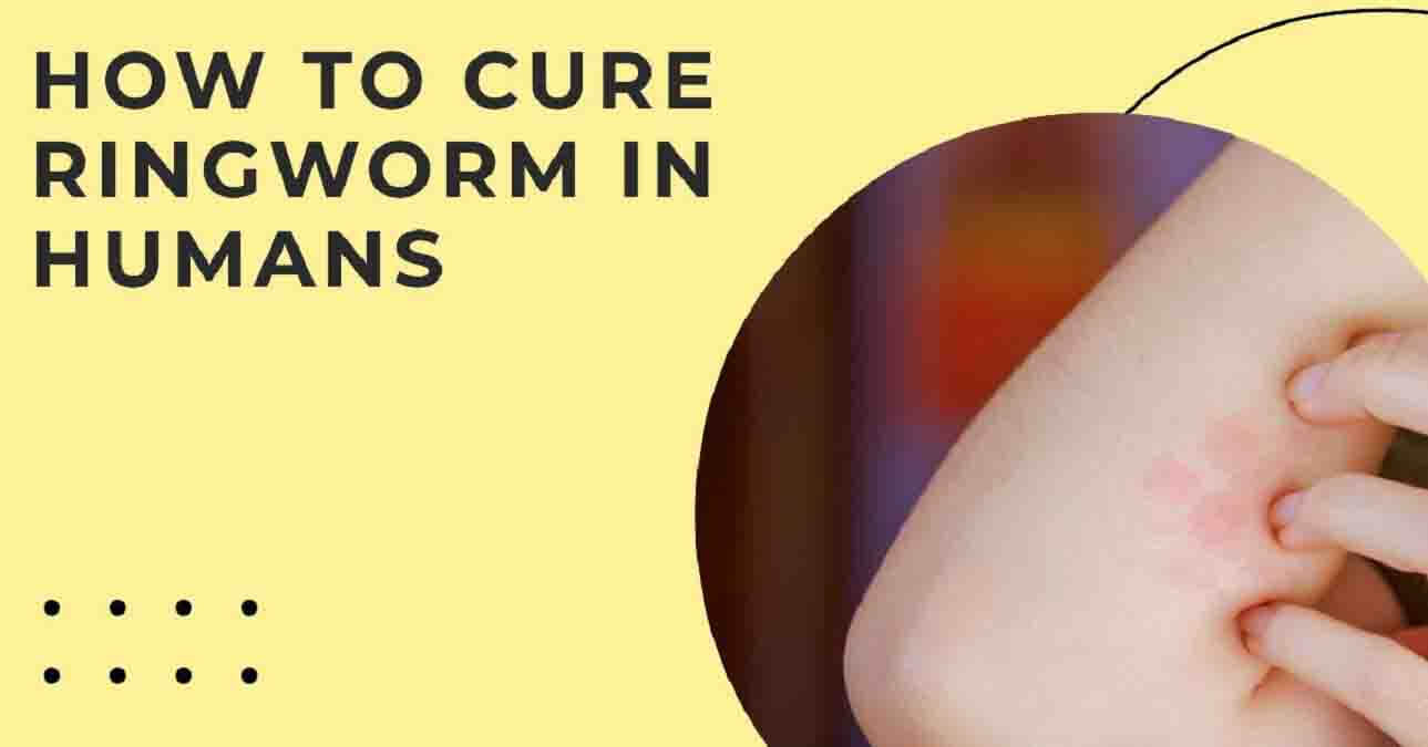 How To Cure Ringworm In Humans