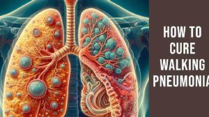 18 Proven Ways How To Cure Walking Pneumonia and Get Back on Your Feet
