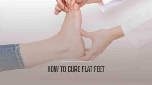 How to Cure Flat Feet