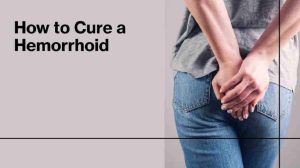 How to Cure a Hemorrhoid