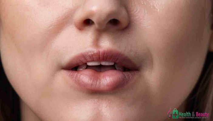 Home Remedies for Canker Sores