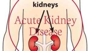 Acute Kidney Disease