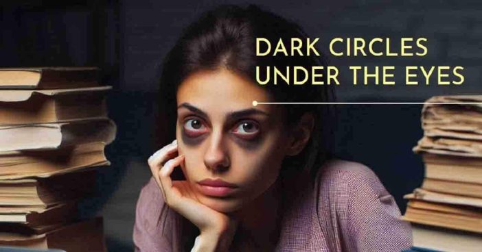 Dark Circles Under The Eyes