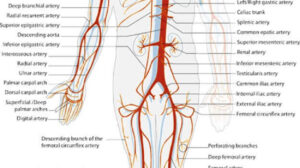 2 Serious Problems that Can Happen in External Iliac Artery