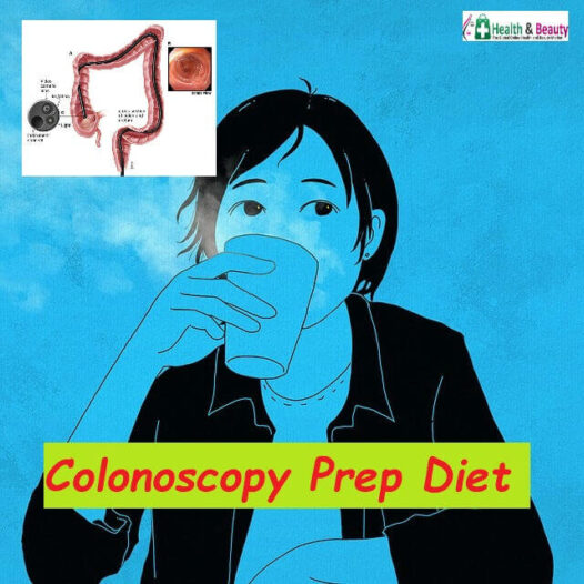Colonoscopy Prep Diet