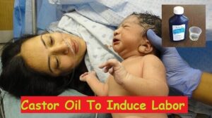 Castor Oil To Induce Labor