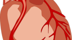 Heart Catheterization Procedure, and 6 Usability