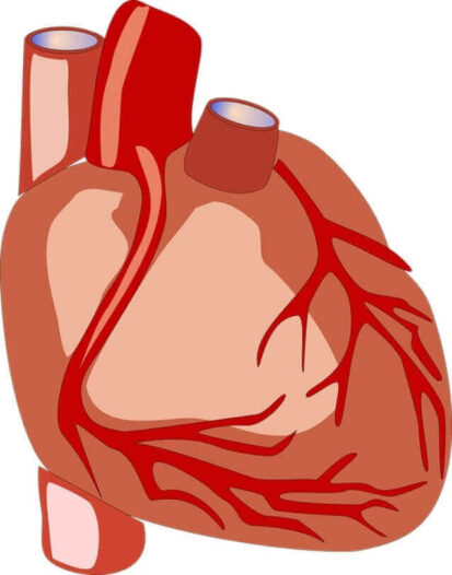 heart catheterization procedure