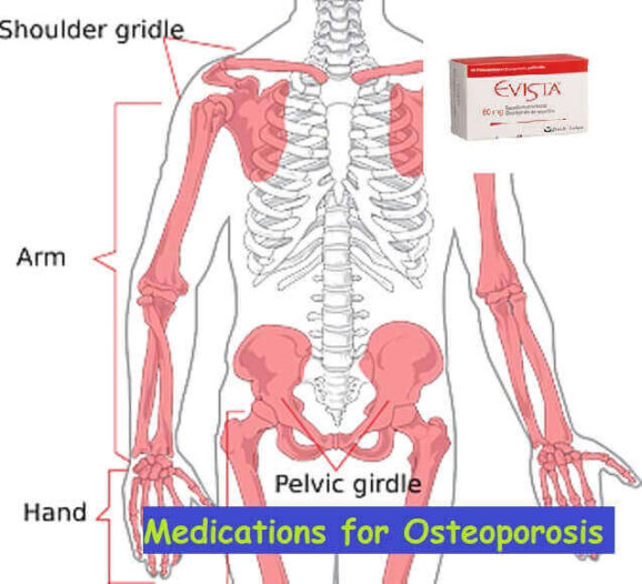 Medications-for-Osteoporosis