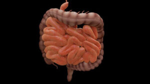 Unveiling the Hidden Dangers of Bowel Obstruction: How to Prevent and Treat the Silent Threat