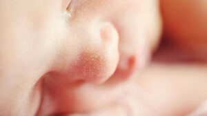 Newborn Acid Reflux: Causes, 21 Symptoms, and Handling