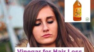 Vinegar for Hair Loss