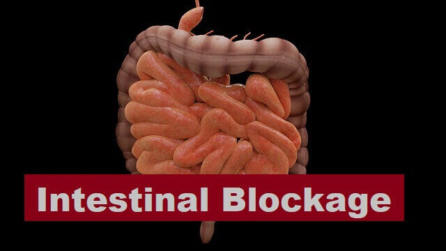 Intestinal Blockage