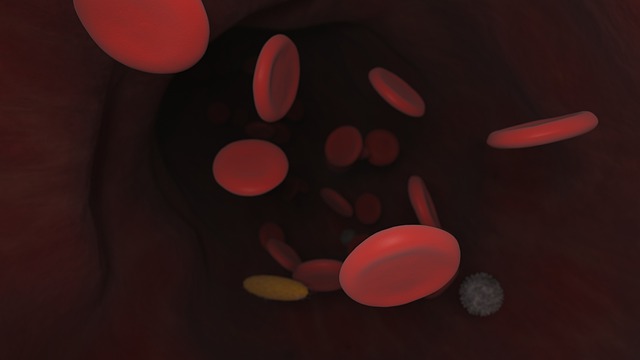 Aplastic Anemia
