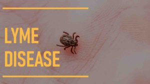 Lyme Disease: Causes, 3 Symptoms, Treatment, and Prevention