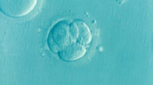 In Vitro Fertilization: Definition, and 5 Stages of How It Works