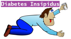Diabetes Insipidus: 4 Causes, Risk factors, and Symptoms