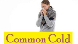 Common Cold: Causes, 4 Risk Factors, Symptoms, Diagnosis, Treatment, and Prevention