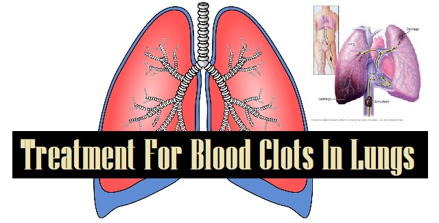 Treatment For Blood Clots In Lungs
