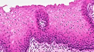 Epithelial Tissue: Definition, 8 Characteristics, General Properties, Structure, and Function