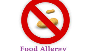 Food Allergy: Definition, 11 Symptoms, Risk Factors, Causes, and Treatment