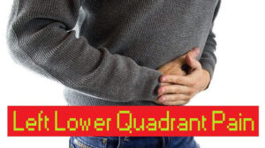 7 Diseases With The Left Lower Quadrant Pain Symptom