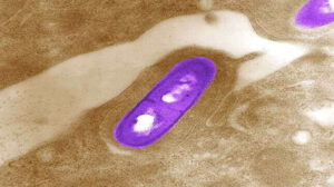 What Is Listeria: 4 Causes, Symptoms, Diagnosis, Treatment, and Prevention