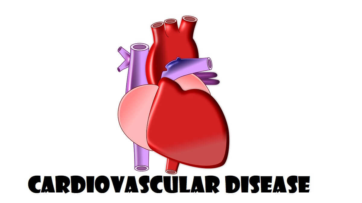 4 Types Of Cardiovascular Disease 1027