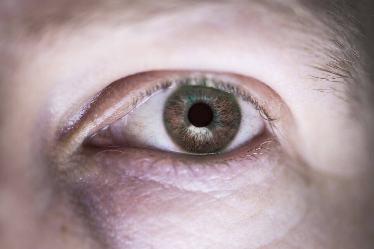 Cornea Transplant Surgery: Definition, 2 Types, Indication, Purposes, and Preparation
