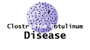 Clostridium Botulinum Disease: 3 Causes, Risk Factors, Symptoms, Diagnosis, Complication, and Treatment