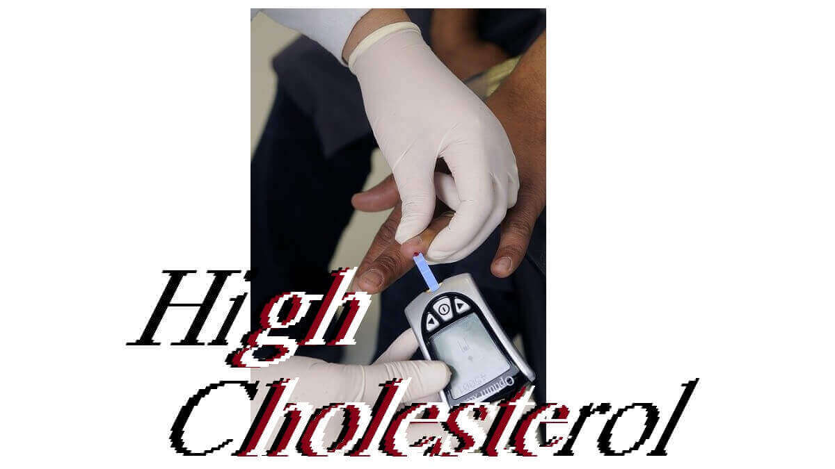 High Cholesterol: 14 Symptoms, Diagnosis, Treatment, and Complications