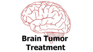 Brain Tumor Treatment