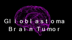 Glioblastoma Brain Tumor