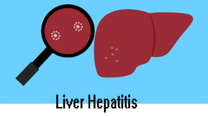 Liver Hepatitis: 5 Types, Causes, Symptoms, and When To See A Doctor