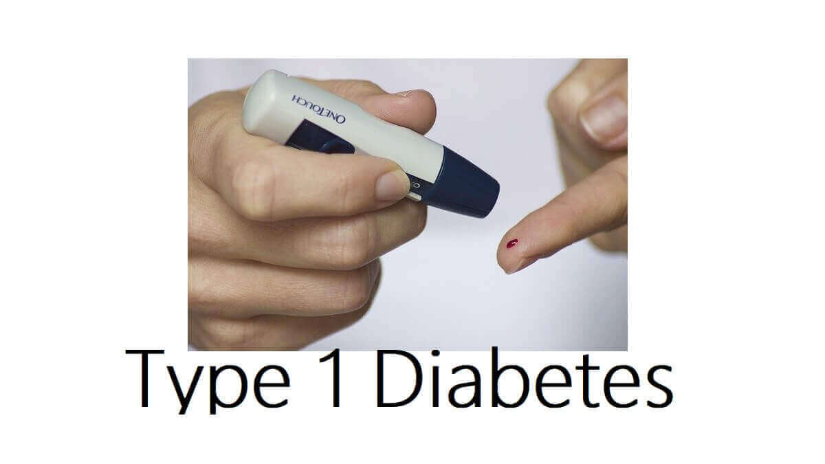 Type 1 Diabetes: 4 Risk Factors, Causes, Symptoms, Diagnosis, and Treatments