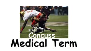 Concuss Medical Term, Causes, 26 Symptoms, and When To See A Doctor