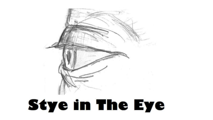 Stye in The Eye
