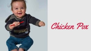 Chicken Pox: Definition, Symptoms, Causes, Risk Factors, Diagnostic Test, Treatment, and Complications