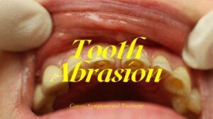 Tooth Abrasion