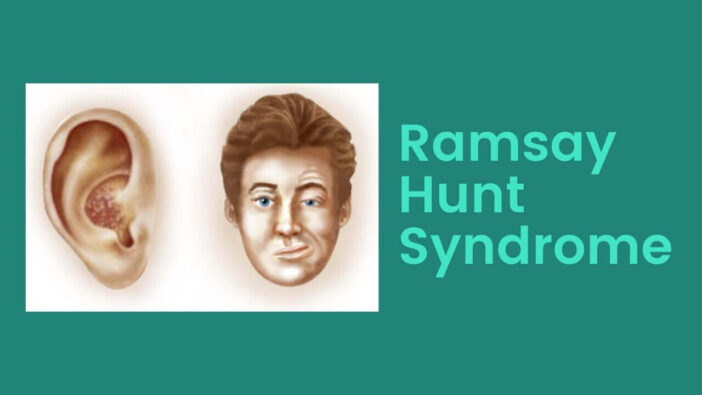 Ramsay Hunt syndrome