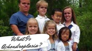 What Is Achondroplasia?