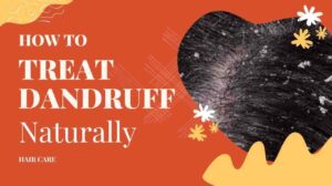 How To Treat Dandruff Naturally
