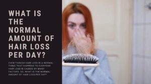 What Is The Normal Amount of Hair Loss Per Day?