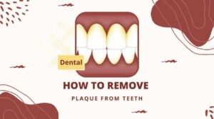 How To Remove Plaque From Teeth