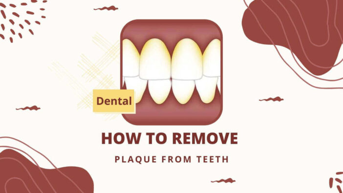 How To Remove Plaque From Teeth