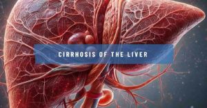 Cirrhosis of the Liver: Understanding and Combating the Silent Epidemic