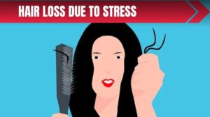 Hair Loss Due To Stress