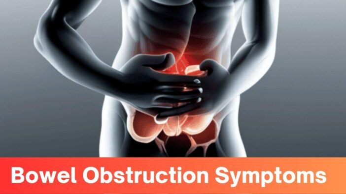 Bowel Obstruction Symptoms
