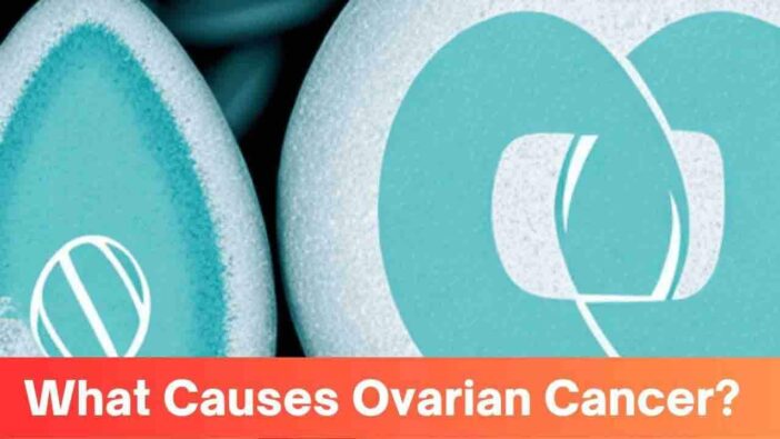 What Causes Ovarian Cancer?